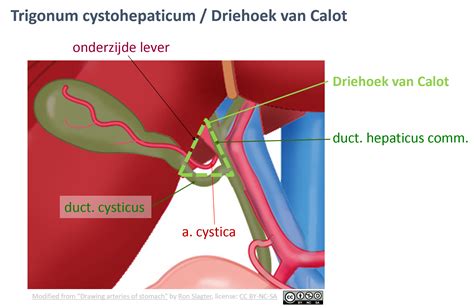 Leiden - Drawing Calot's triangle - Latin labels | AnatomyTOOL