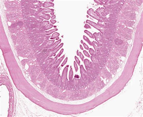 Image result for Ephilehal Tissue Sample