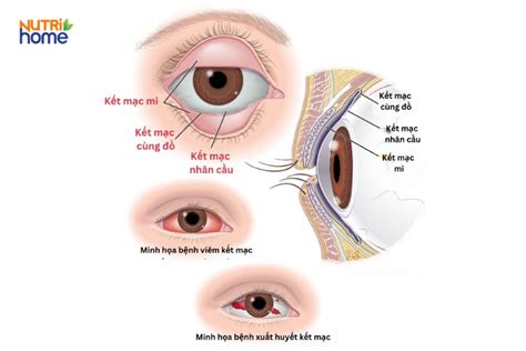 Image result for Example of MLA Style Appendix