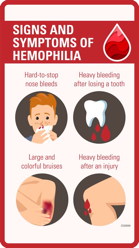 Hemophilia Buttons | Hemophilia | CDC