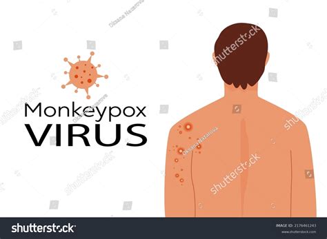 168 Pimple On Back Vector Images, Stock Photos & Vectors | Shutterstock