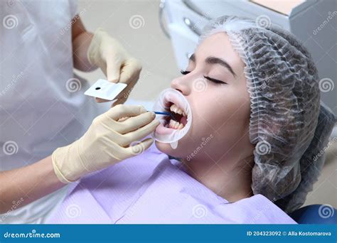 The Dentist Applies The Gel To The Patient`s Teeth Before Professional Dental Cleaning ...