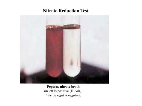 Image result for Positive Nitrate Test