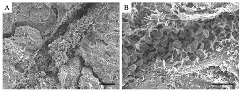 Histopathological Analysis of Lipopolysaccharide-Induced Liver ...