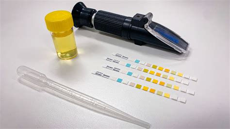 Specific Gravity Test For Urine