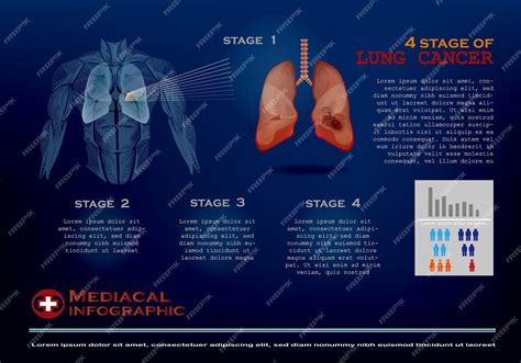 Premium Vector | 4 stage of lung cancer infographic