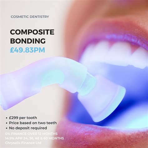Does Composite Bonding Damage Teeth? | The Gentle Dental