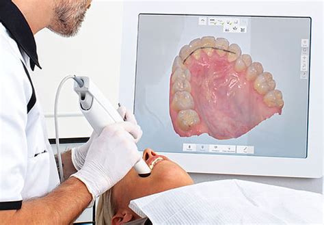 Invisalign Gurgaon – Certified Provider, Free Scan