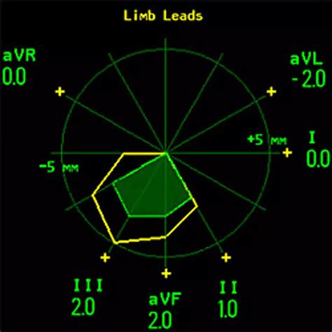 Clinical decision support - Philips