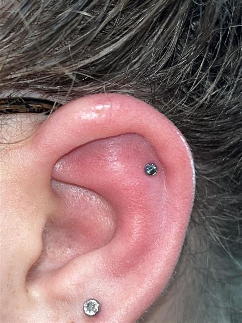 1 Week post pierce - Normal or not normal helix swelling? : r/piercing