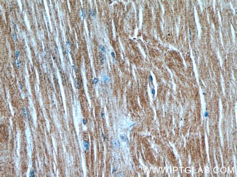 MAP4K4 antibody (55247-1-AP) | Proteintech