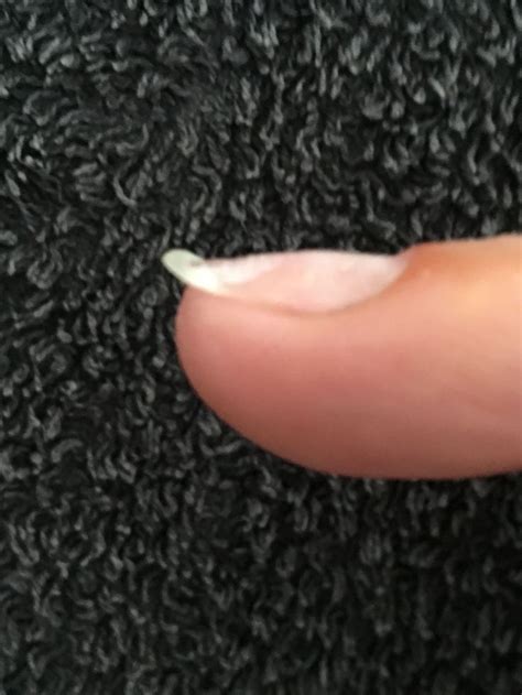 eggshell nails definition quizlet
