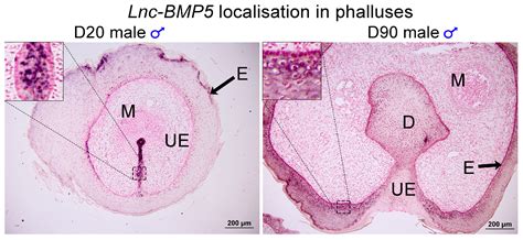 Androgen and Oestrogen Affect the Expression of Long Non-Coding RNAs ...