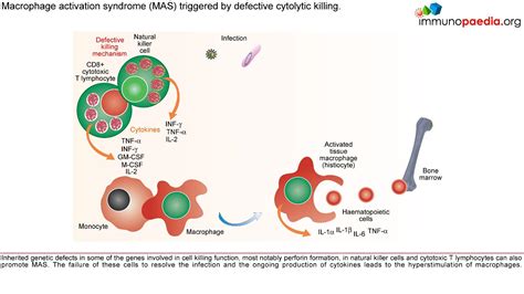 Macrophage activation syndrome Case Study | Immunopaedia