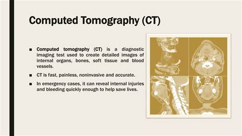 Statistical Parametric Mapping 的图像结果