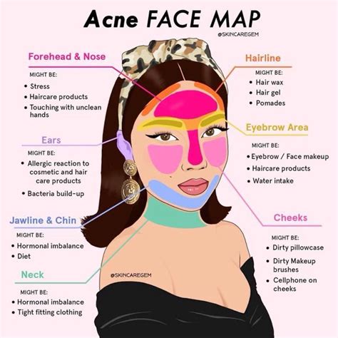 How to prevent forehead acne – Artofit
