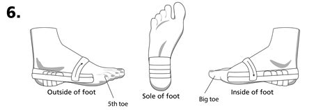 Royal Orthopaedic Hospital - Low Dye Taping for Plantar Heel Pain
