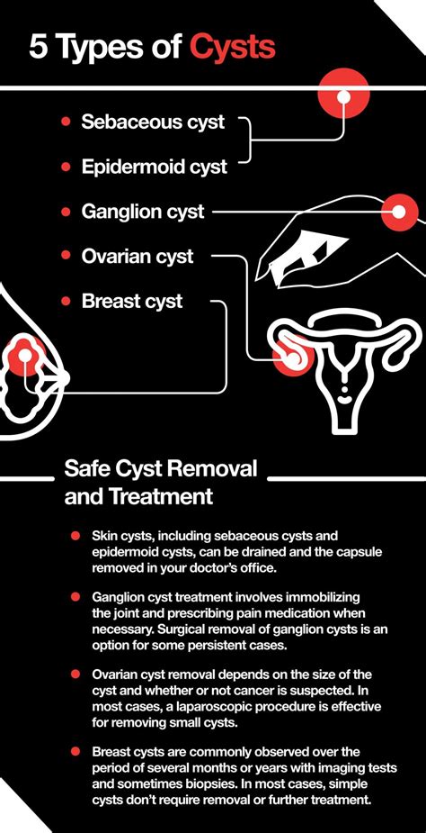 How Do You Get Rid of a Cyst? – The Amino Company