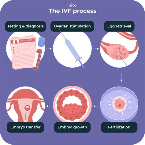 IVF Process Step by Step 的图像结果