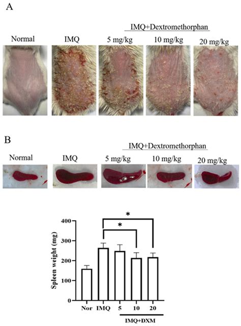 Dextromethorphan Exhibits Anti-Inflammatory and Immunomodulatory ...