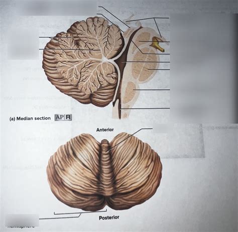 Brain 的图像结果