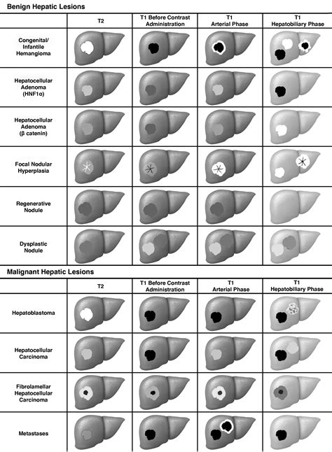 Hepatobiliary MRI Contrast Agents: Pattern Recognition Approach to ...