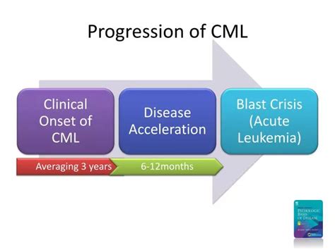 Image result for CML Graph