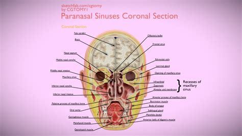 Paranasal Sinuses 3d