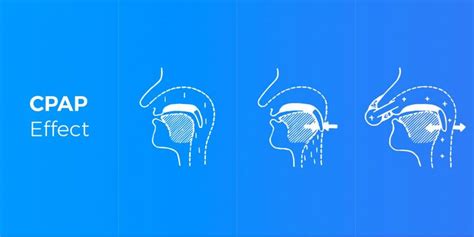 Image result for Basic CPAP and BiPAP