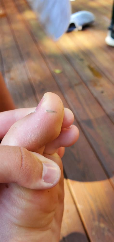 Image result for Toe Bro Splinter