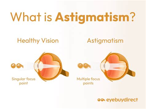 What is Astigmatism? | Eye Health and Fashion Blog | Eyebuydirect