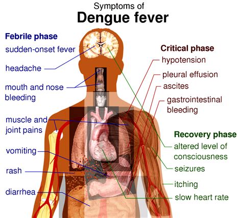 Dengue fever Symptoms - Hetero Healthcare - Medium