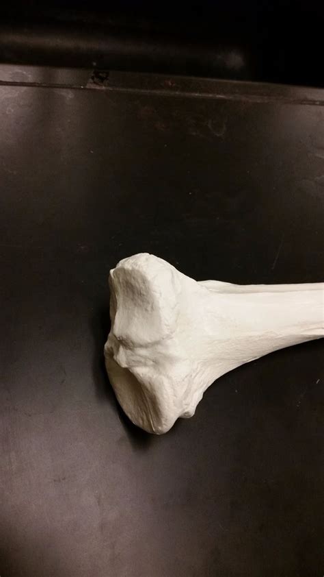 Proximal Tibia 的图像结果