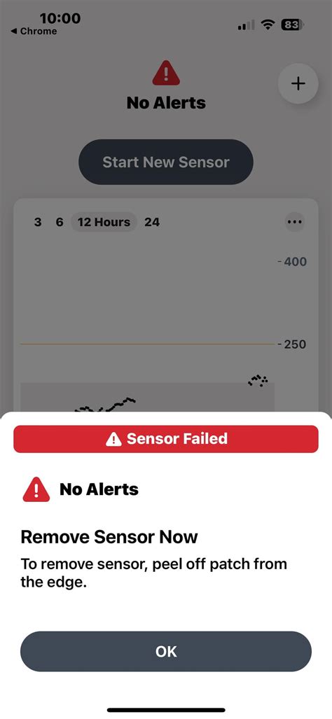 Image result for Dexcom Keeps Loosing Sensor Signal