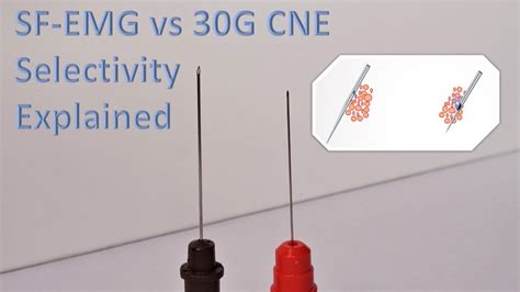 Image result for Single Fiber EMG Test