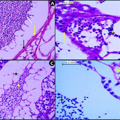 Image result for Transillumination Test Testis