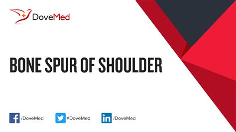 Bone Spur of Shoulder