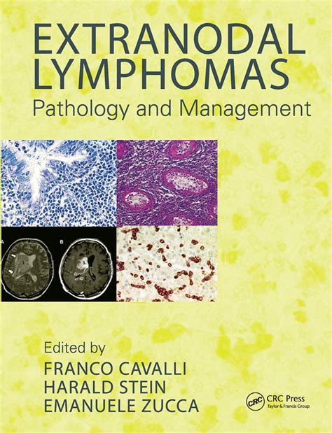 Buy Extranodal Lymphomas Book Online at Low Prices in India ...