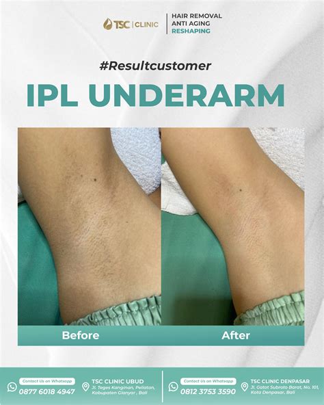 TSC Aesthetic Clinic Bali (@tscclinicbali) • Instagram photos and videos