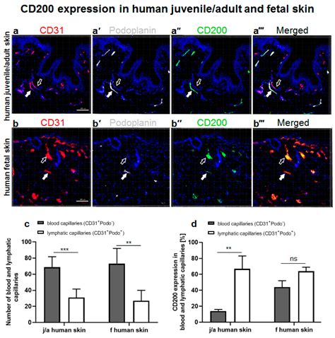 The Role of CD200–CD200 Receptor in Human Blood and Lymphatic ...