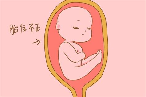 孕检时发现胎位异常，孕妈不要慌，这几个方法帮助胎儿恢复正常胎位