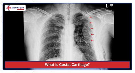Study The Anatomy of Costal Cartilage: Location and Function