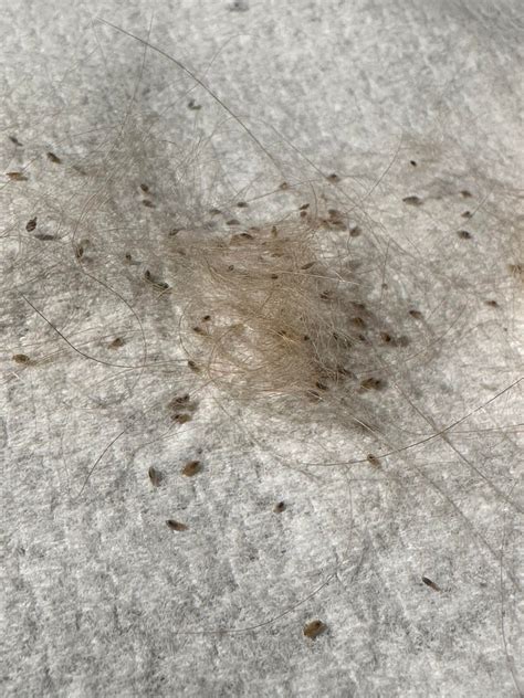 Fleas or Lice? : r/Pets