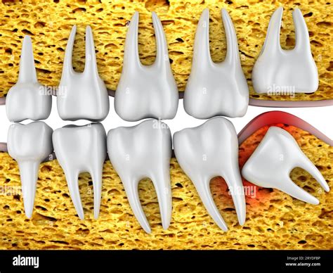 Molars and wisdom tooth Stock Photo - Alamy