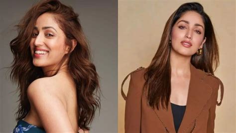 Yami Gautam Is Suffering From Rare Skin Disease Keratosis Pilaris: Here ...