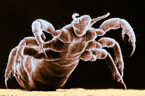 Ever Feel Your Skin Crawling? Maybe You Can Thank Evolution. - The New York Times