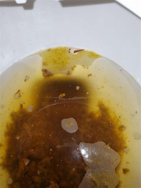 Fatty diarrhea with white foam and oil on the top : r/medical