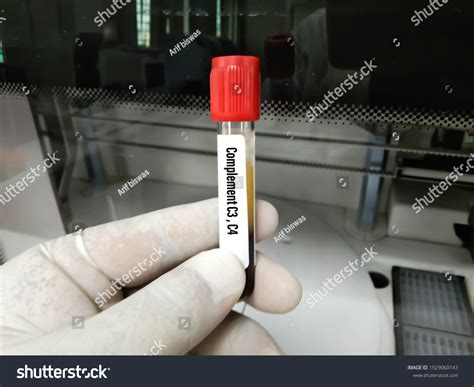 Image result for C4 Complement Blood Test
