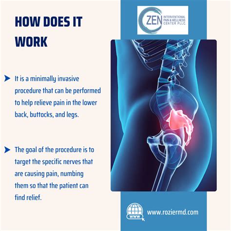 Recognize Ganglion Impar Block Is Right for You In Mansfield, Tx
