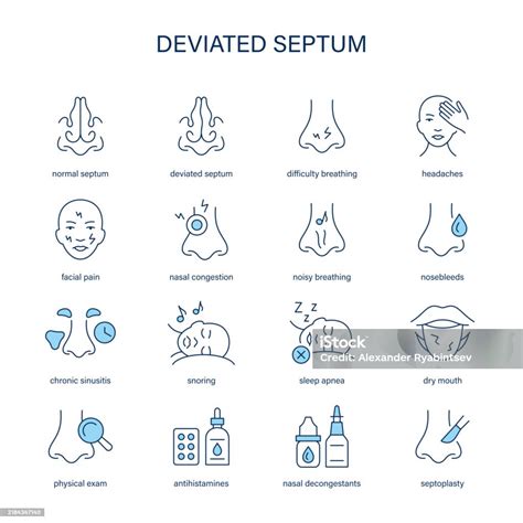 Deviated Septum Symptoms Diagnostic And Treatment Vector Icon Set Medical Icons Stock ...